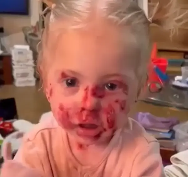 Agatha em tratamento contínuo por epidermólise bolhosa